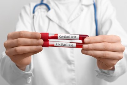 Non è lo stress: il tuo intestino cambia personalità in estate (e nessuno te lo dice)