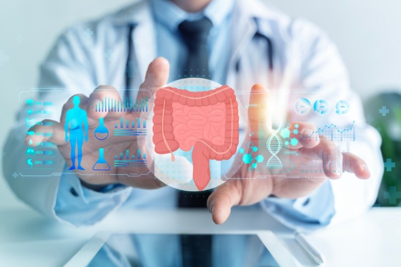 Non è lo stress: il tuo intestino cambia personalità in estate (e nessuno te lo dice)