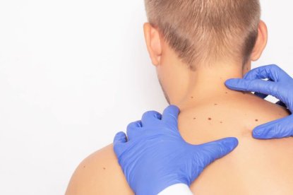 Emorroidi e Fibroma Pendulo: differenze e come riconoscerle