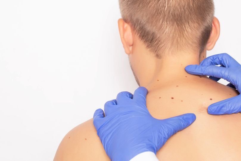 Emorroidi e Fibroma Pendulo: differenze e come riconoscerle Emorroidi e Fibroma Pendulo: differenze e come riconoscerle